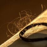 Saç dökülmesine ‘mevsimsel’ deyip geçmeyin! Çoğumuz bunu yaşıyoruz ama sebebini bilmiyoruz... İşte türleri ve tedavi yöntemleri